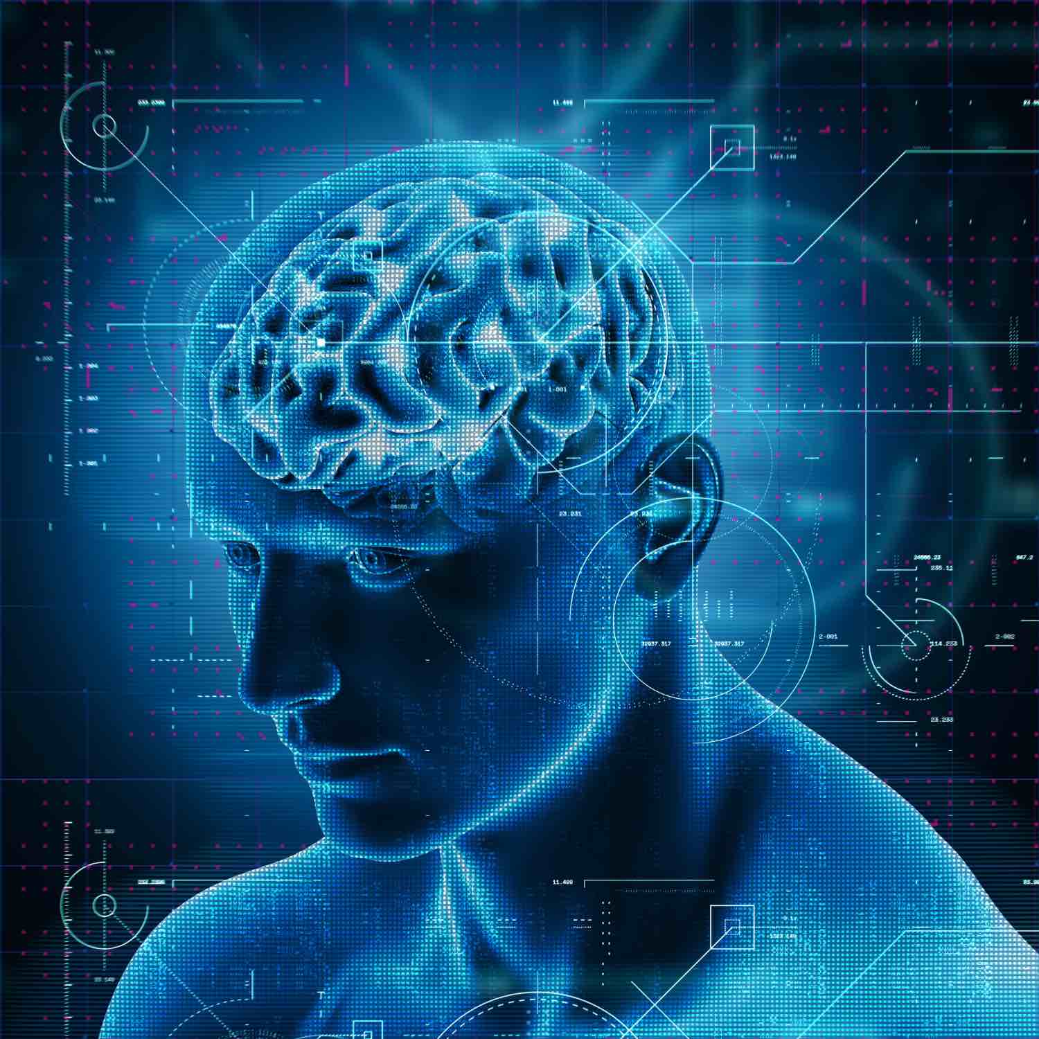 pain neuromatrix